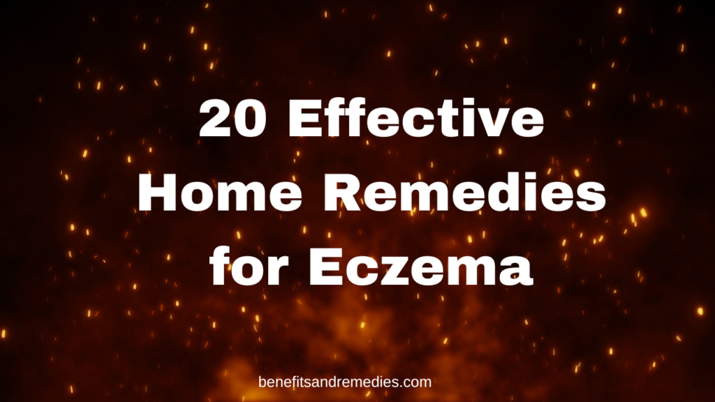 home remedies for eczema