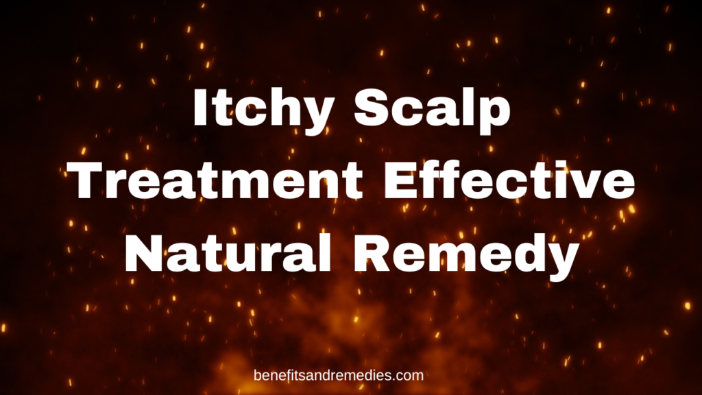 itchy scalp treatment